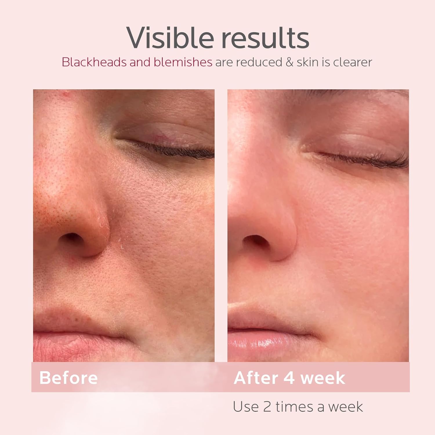 Colorfarm Facial Steamer Nano Ionic: Face Steamer Home Spa Kit Deep Cleaning Unclogs Pores Sinuses Inhaler with 8 Skin Care Tools - Self Care Gifts for Women (Deep Cleansing Facial Kit) - Image 6