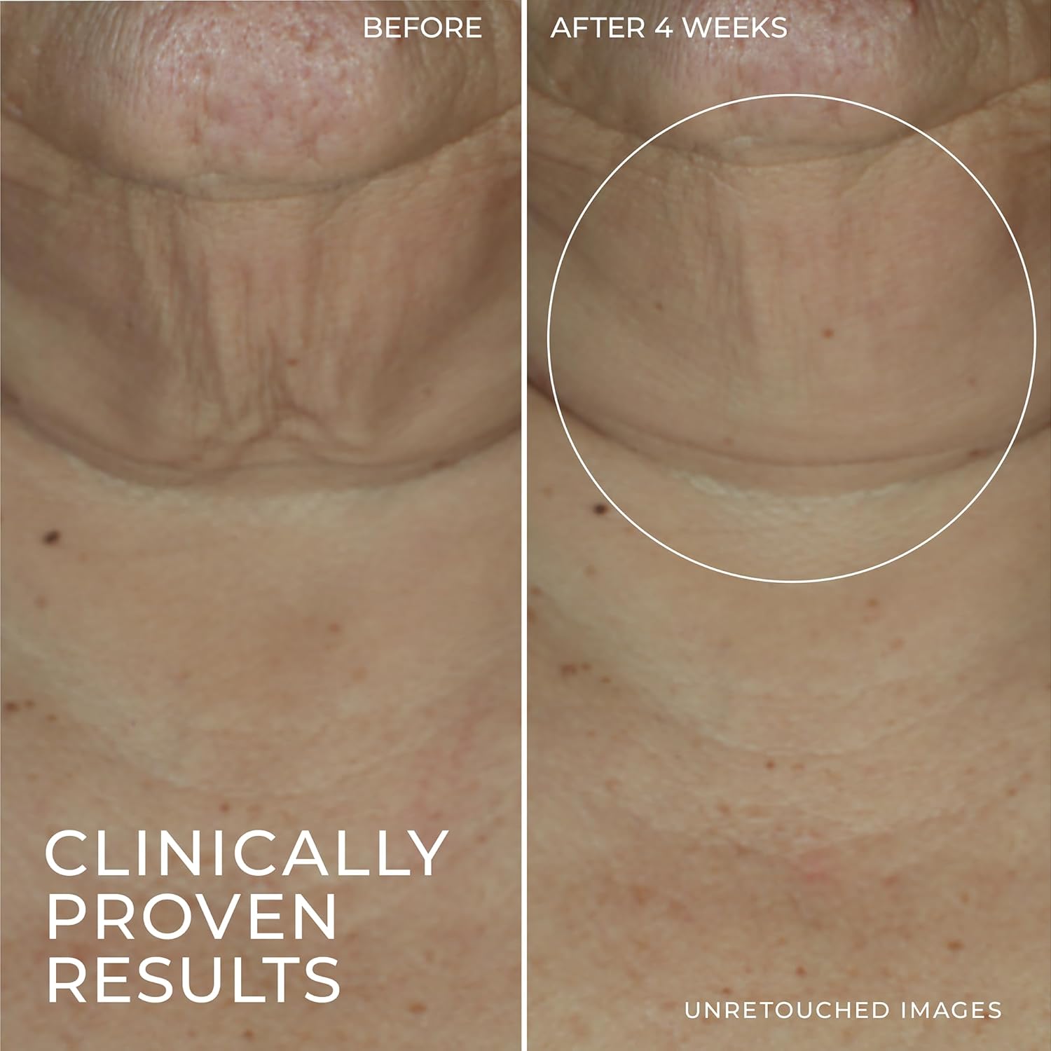 RoC Derm Correxion Advanced Retinol Firming Serum Stick with Antioxidants to Visibly Tighten and Firm Wrinkles and Laugh Lines, 1.0 oz with Retinol Eye Cream Packette - Image 6