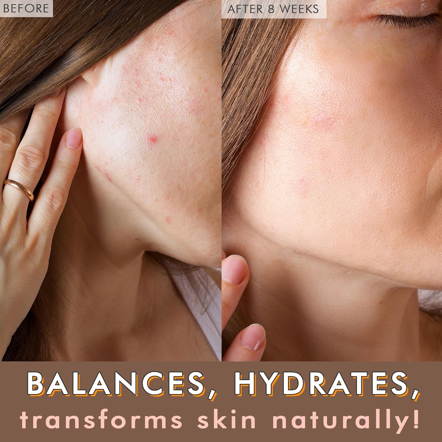 USDA Organic Face Oil - USA Made with Natural Ingredients, Anti Aging Formula for Acne-Prone & Oily Skin, Facial Oil with Vitamin E, Rosehip, Argan & Jojoba Oils for Sensitive Skin, Eczema & Rosacea - Image 2