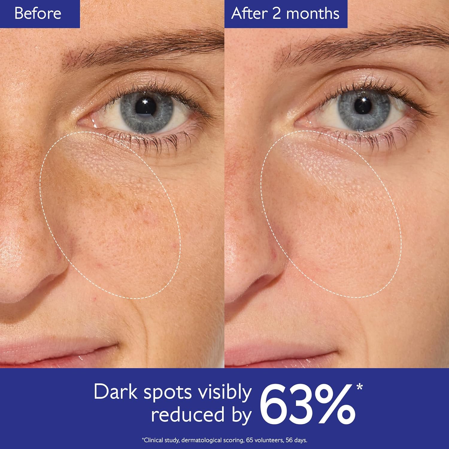 Caudalie Vinoperfect Brightening Dark Spot Serum Vitamin C Alternative - 62x More Effective than Vitamin C with Viniferine for a Visibly Brighter Even Complexion - Image 4