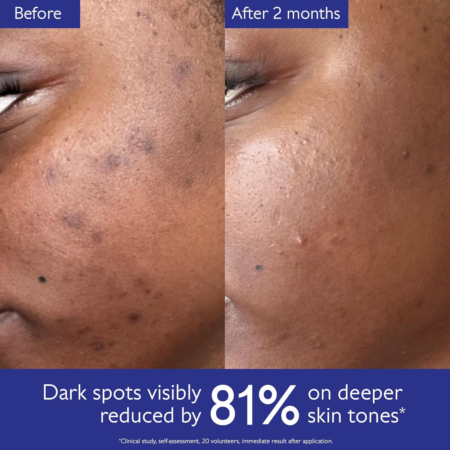 Caudalie Vinoperfect Brightening Dark Spot Serum Vitamin C Alternative - 62x More Effective than Vitamin C with Viniferine for a Visibly Brighter Even Complexion - Image 5