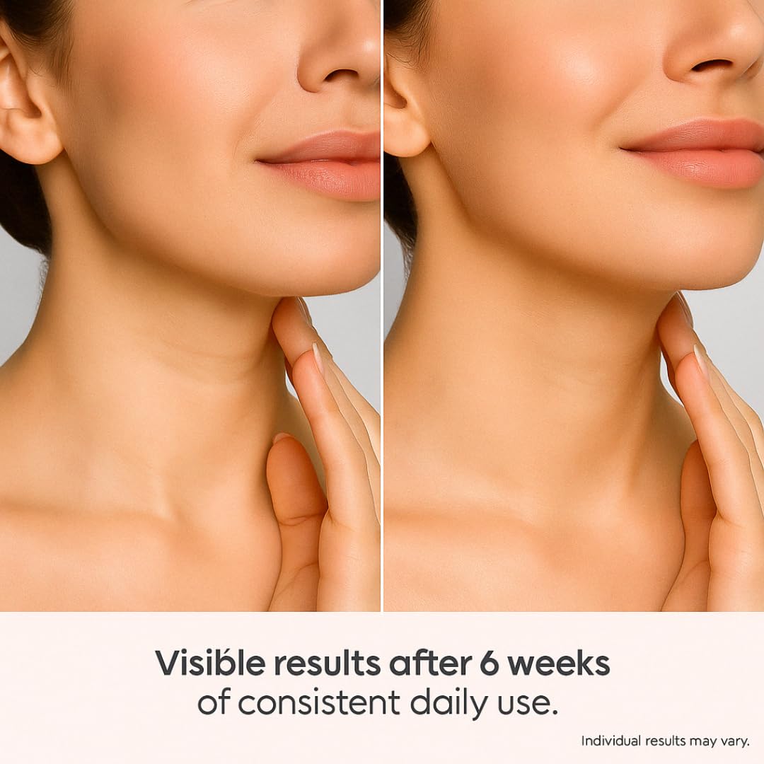 V-Y Shape Face & Neck Cream – Anti-Aging Lifting & Firming with 5 Biotech Peptides, Lipofilling Complex & Up-Gravity Complex – Sculpts Jawline, Rejuvenates Skin – Dermatologically Tested - Image 8