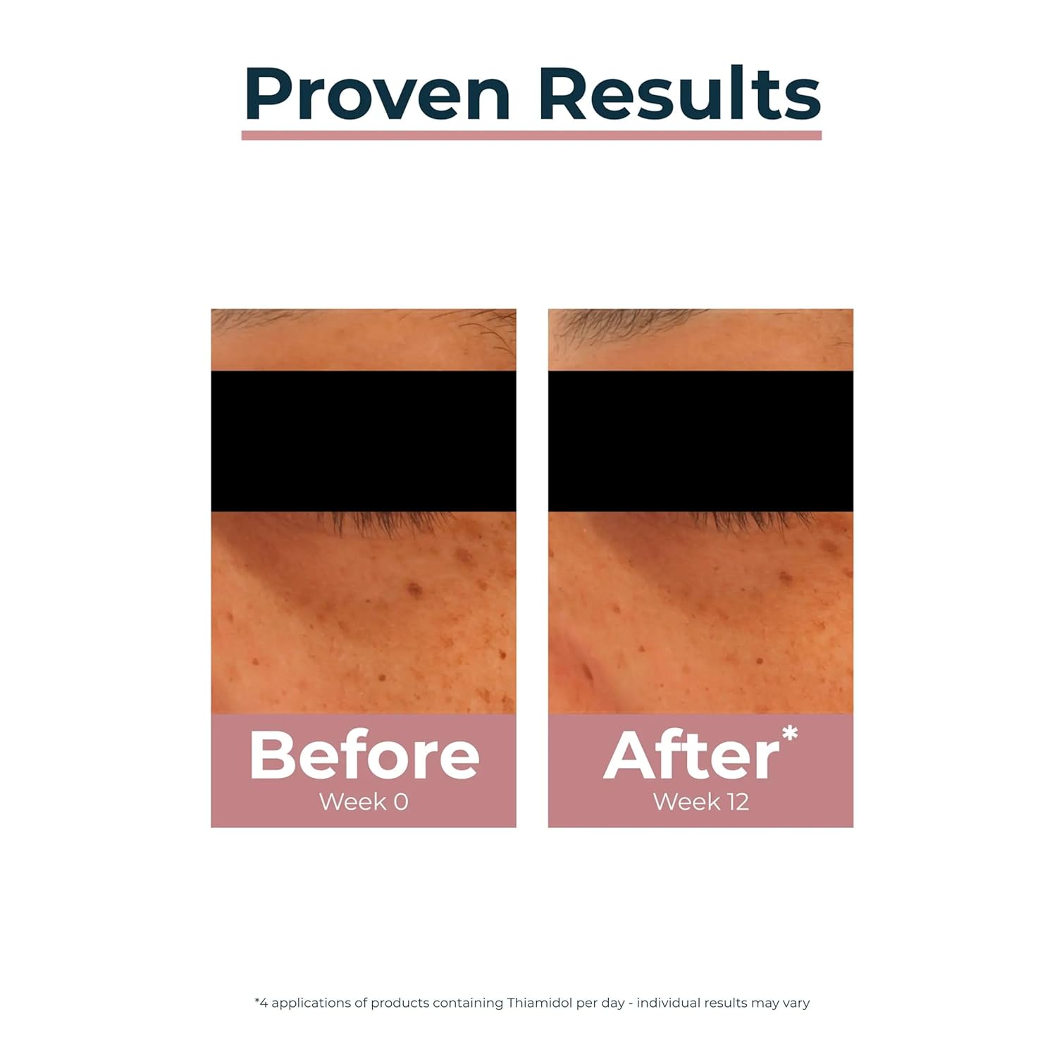 Eucerin ANTI-PIGMENT lightening eye contour 15 ml - Image 5