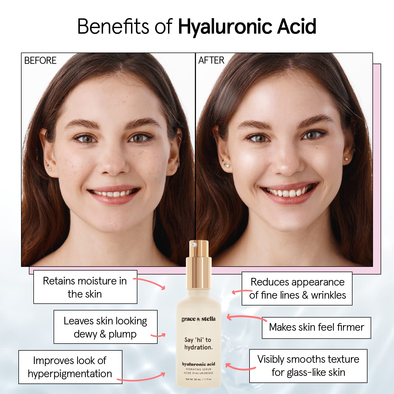 grace & stella Award Winning Hyaluronic Acid Serum (50ml/1.7 fl oz) Hydrating Hyaluronic Acid Serum for Face - Acido Hialuronico for Women - Remove Fine Lines, Wrinkles, Anti Aging - Vegan Skincare - Image 3