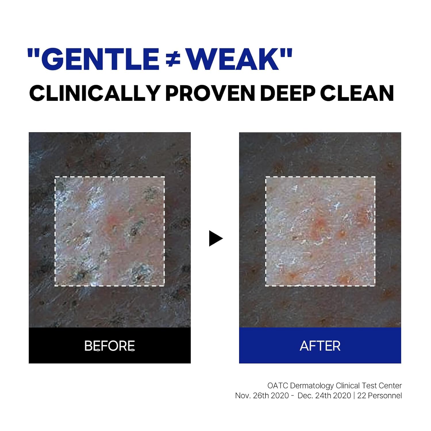 ROUND LAB Birch Juice Moisturizing Cleanser | Unclogs hidden sebum, Clears away dead skin cells., Soothing, Low pH, Gel Type Cleanser (5.07 fl.oz) - Image 7