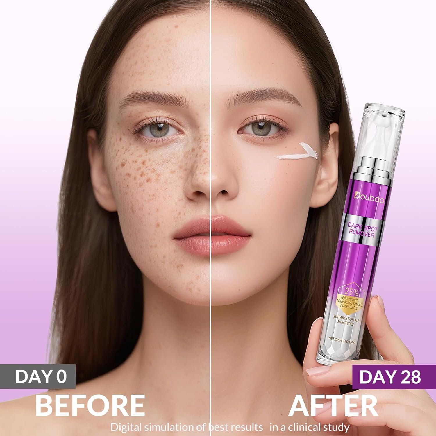 Dark Spot Remover for Face and Body, Age Spot Sun Spot Freckles Remedy Corrector Serum,Melasma Treatment for Face, Advanced Fade Cream for Uneven Skin Tone with 360° Roller Massage Ball, 0.5 FL oz - Image 3