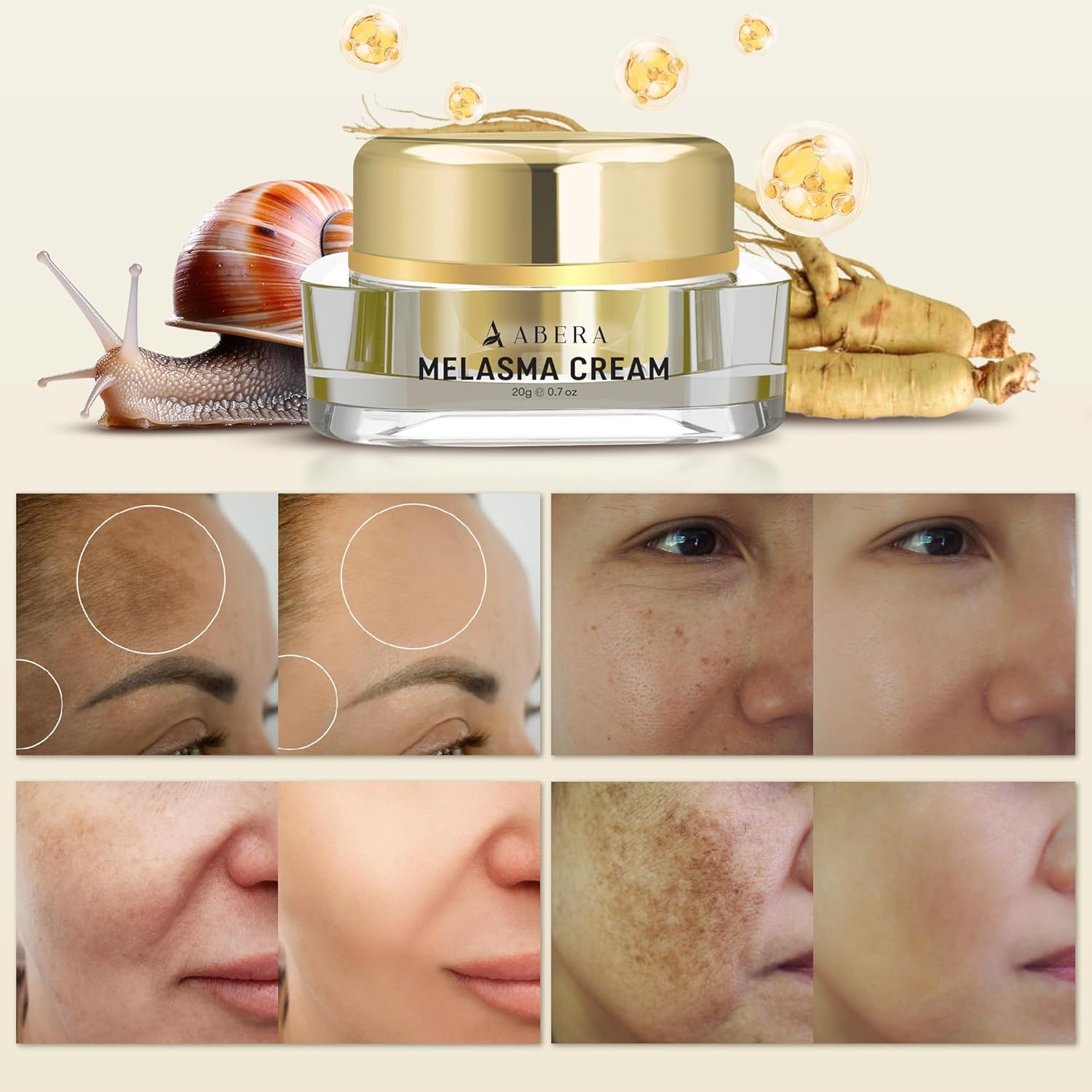 ABERA Face Cream (Premium Version) - Hydrating and Repairing Cream for Dry Skin, Gentle and Nourishing Formula for All Skin Types (2 Boxes + 5 Eye Patches) - Image 9