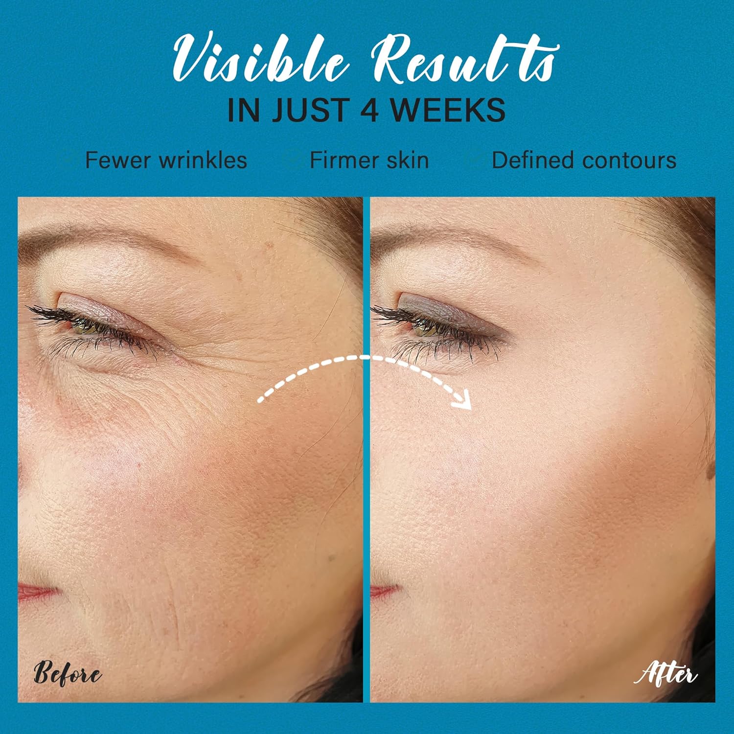 Tighten and Lift Neck Cream: Instant Face Lift Cream - 6-in-1 Anti-Aging Face Moisturizer for Anti-Wrinkle, Firm - Collagen, Retinol, Peptides & Hyaluronic Acid Neck Firming Cream for Skin Care - Image 5