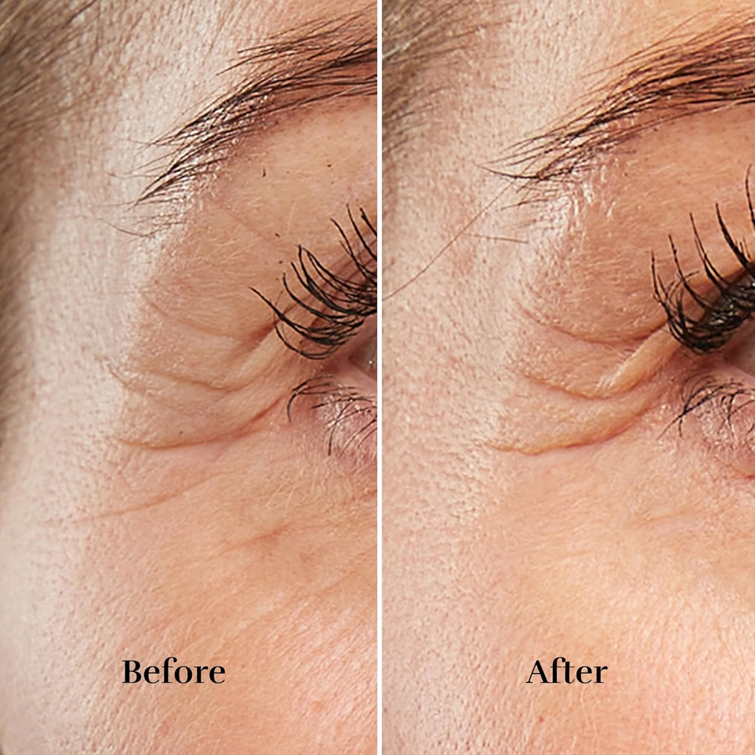 Silk’n Anti-Aging Device - Titan Mini - Wrinkle Reduction and Skin Tightening - Rejuvenates Skin on Smaller Face Areas - Cordless Use - Skin Care Device with LED - Unisex Hygiene and Personal Care - Image 4