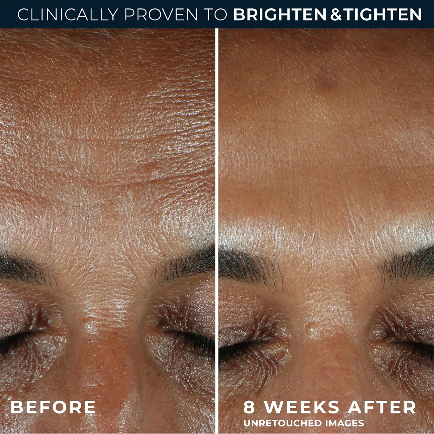 RoC Multi Correxion Revive + Glow 10% Active Vitamin C Serum for Face, Daily Anti-Aging Wrinkle and Skin Tone Skin Care Treatment, Brightening Serum, 1 Fluid Ounce - Image 4