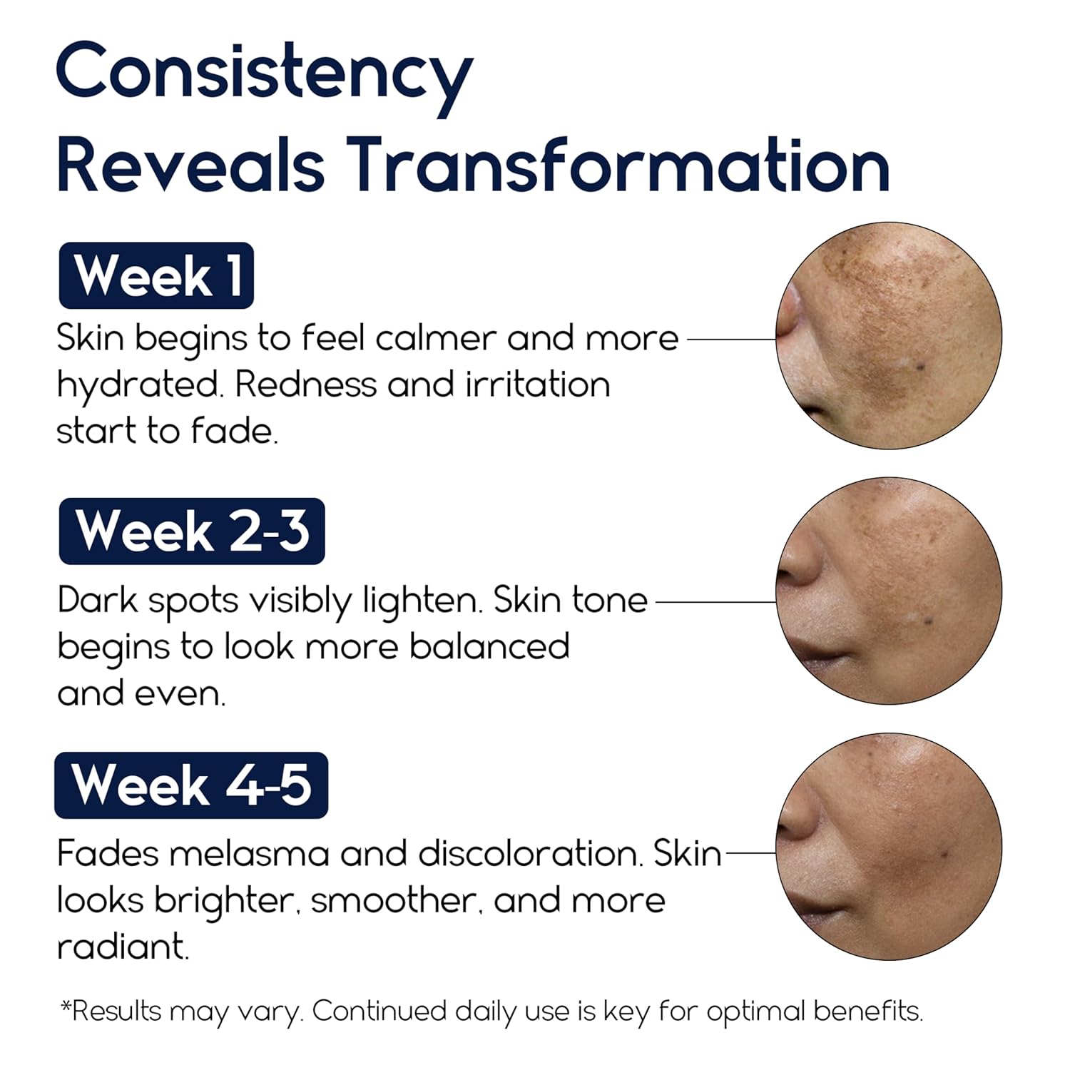 Melasma Treatment for Face - Melasma Cream & Age Spot Remover for Skin Discoloration, Post-Blemish Marks, Scars & Spots | Dark Spot Remover for Face & Body - Image 2