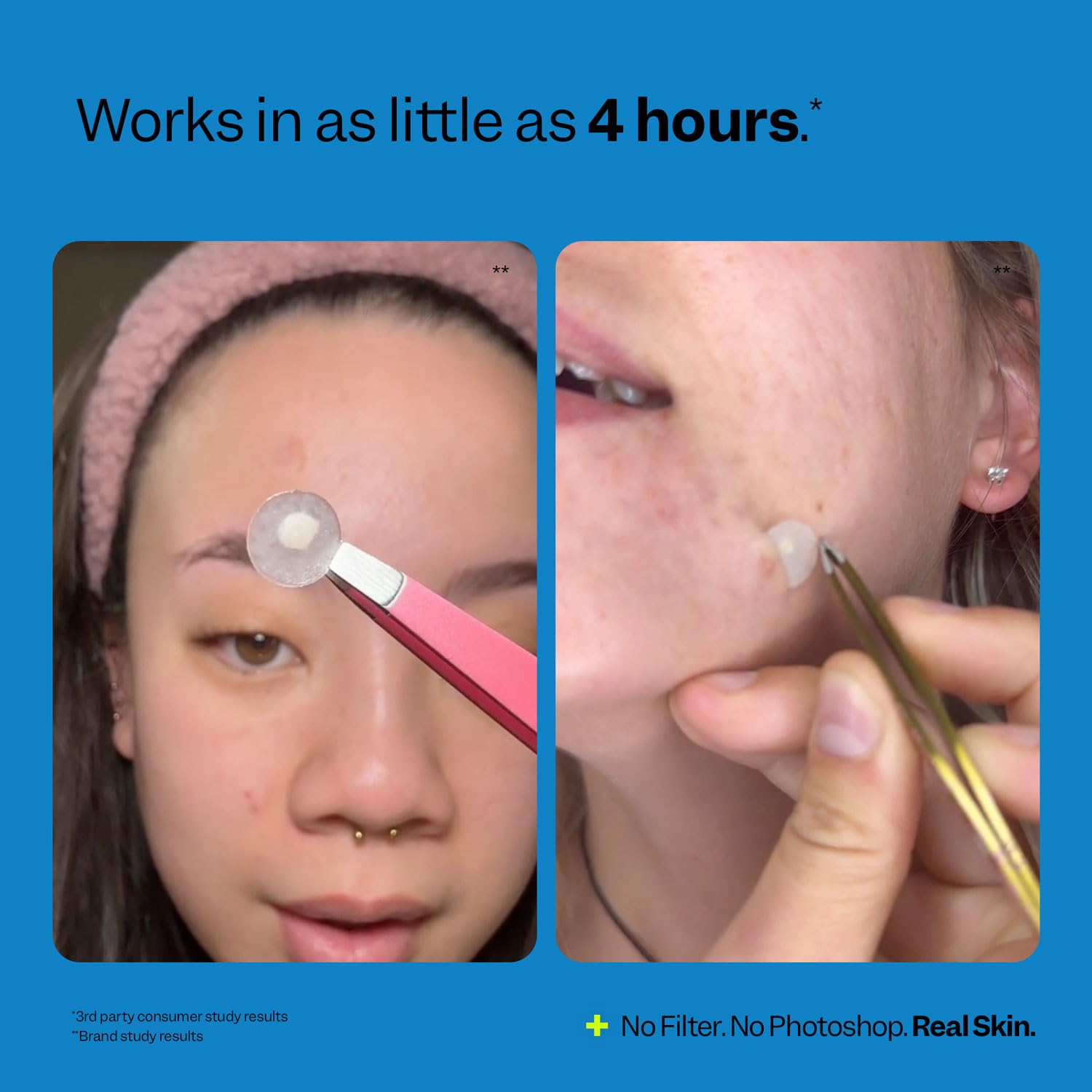 Peach Slices | Acne Spot Dots | Hydrocolloid Acne Patches | For Zits, Blemishes, & Breakouts | Vegan | Cruelty-Free | Pimple Patches | Facial Skin Care Products | 3 Sizes (7mm, 10mm, & 12mm) | 30 Ct - Image 6