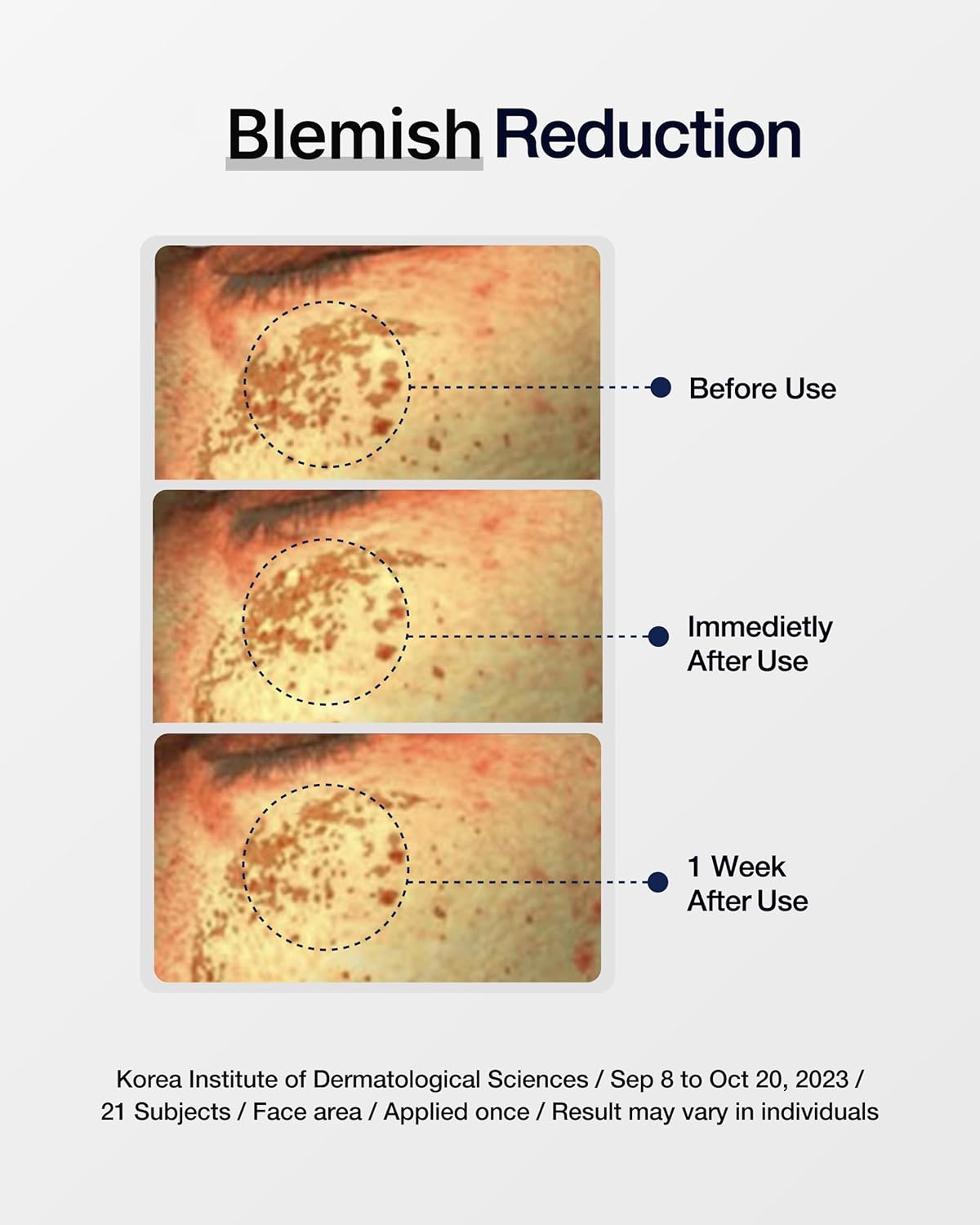 CENTELLIAN 24 Expert Madeca Cream (1.69fl oz) - Premium Lasting Hydration Moisturizer for Dry, Sensitive Skin. Centella Asiatica, TECA, Gotu Kola - Image 3