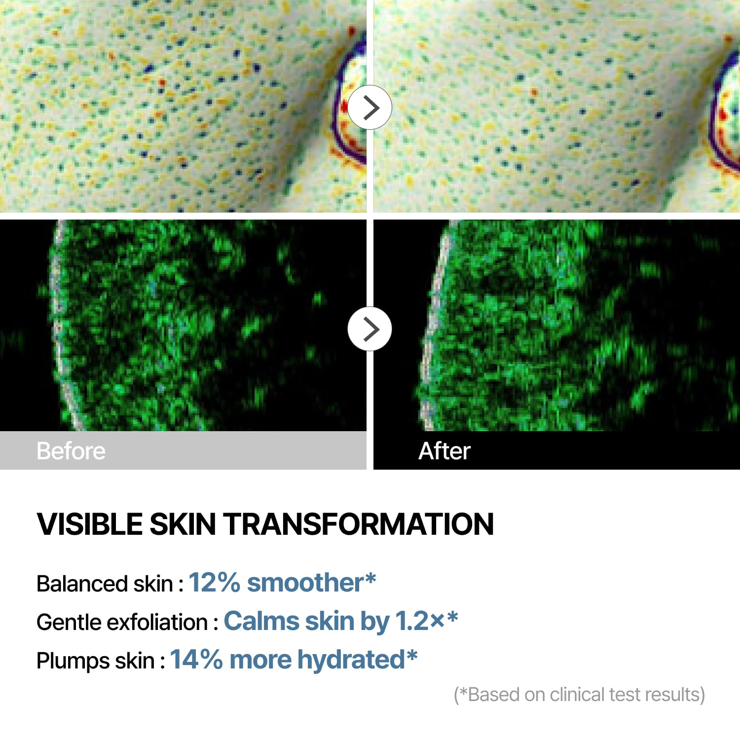 THOME Glow Peel One Day Kit – Korean 4-Step Radiant Skincare Facial – Low Irritating & Gentle on Sensitive Skin – Brightens, Smooths & Strengthens Barrier (1 Sheet) - Image 3