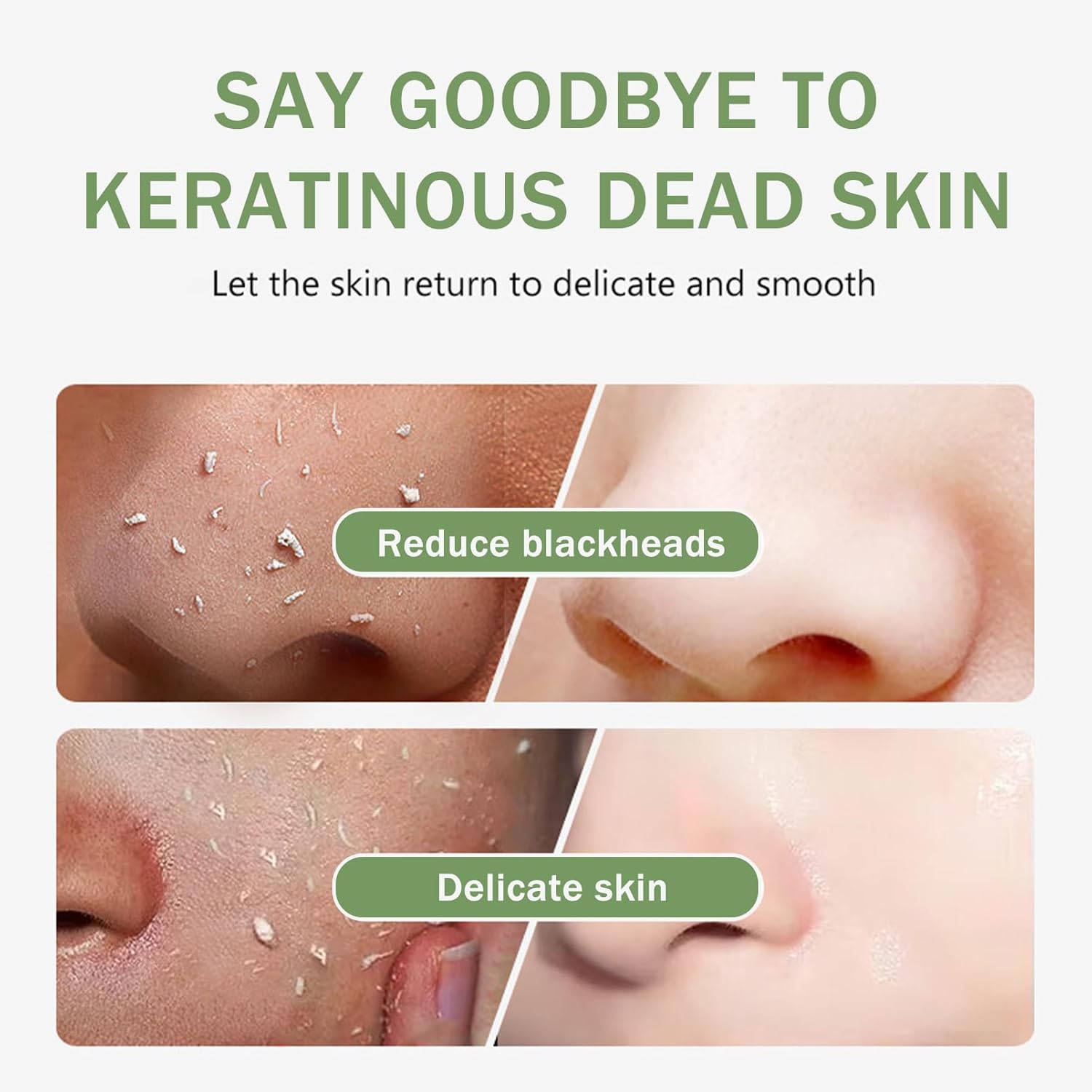 Purifying Exfoliating Gel with Face Washing Brush, Exfoliating Face Wash, Deep Cleansing Peeling Gel for the Whole Body, Facial Scrub Exfoliator, Oil & Dirt Cleanser for All Skin Types (1PCS) - Image 4