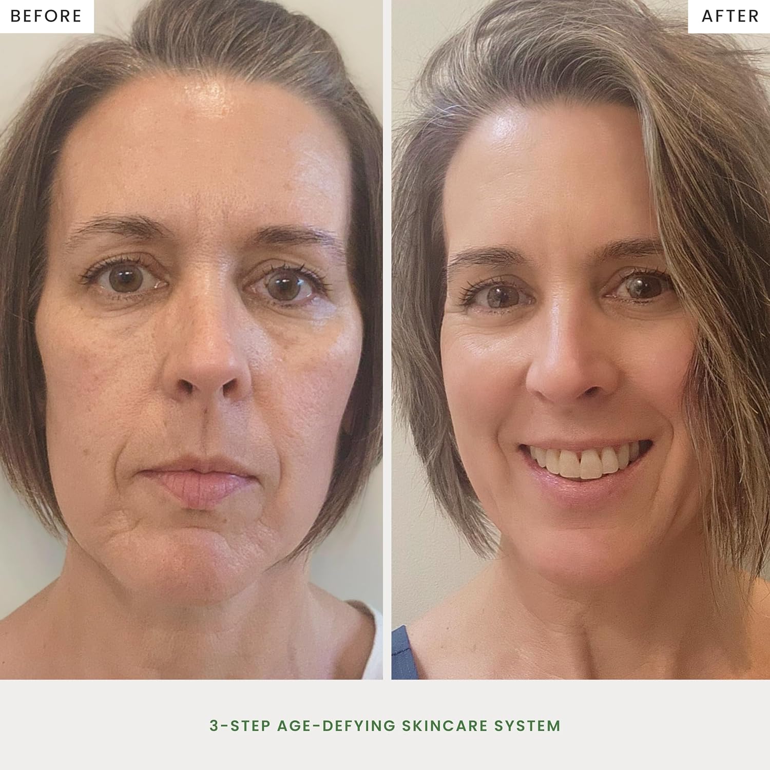 The Spa Dr. 3-Step Age-Defying Skincare System - Antiaging SkinCare Set for Women - Anti Aging Skin Care Sets for Women - Skin Care Routine: Cleanser, Age Defying Lift & Tight Serum, Moisturizer - Image 6