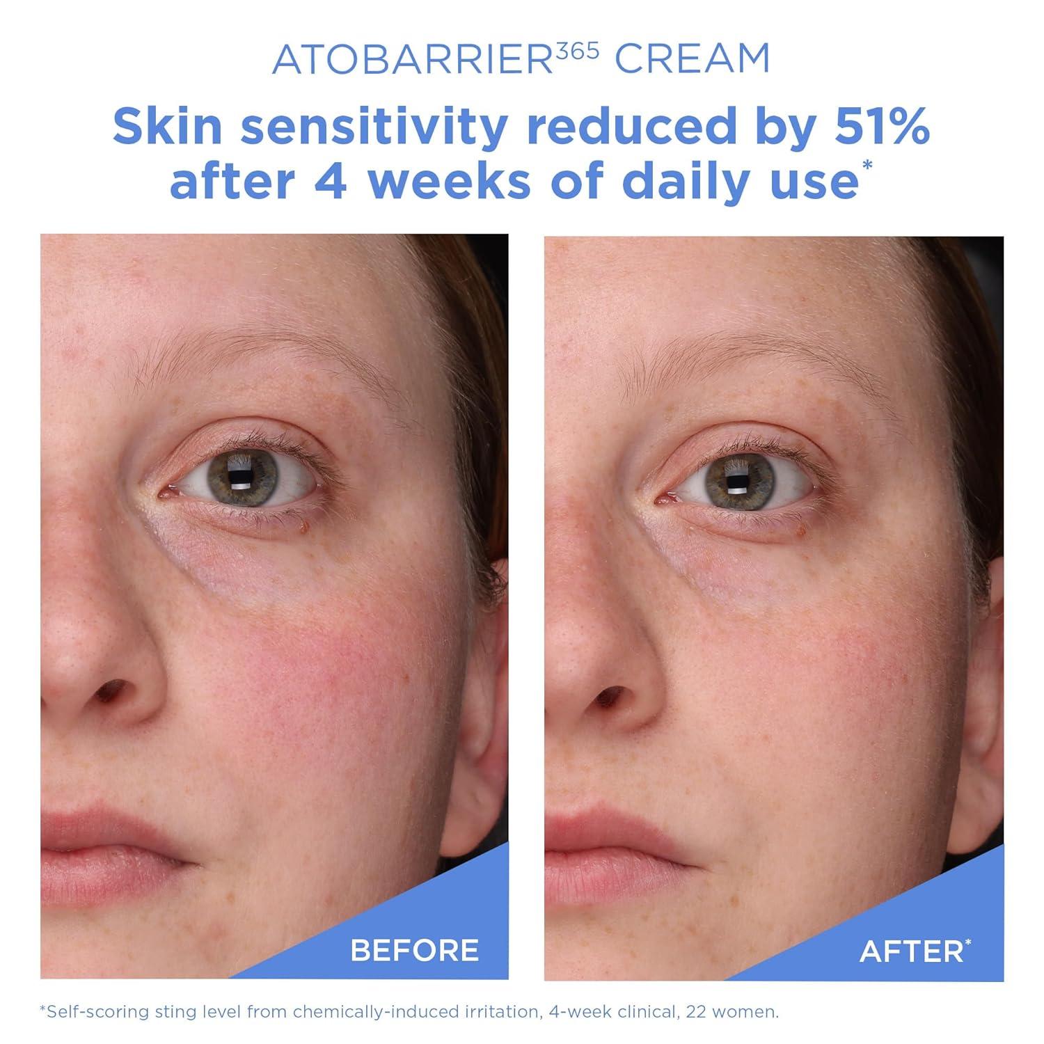 AESTURA ATOBARRIER365 Cream with Ceramides, Korean Face Moisturizer for Barrier Repair | 120H lasting Hydration, Ceramide Capsules, Dry & Sensitive Skin, Non-comedogenic, 80 mL / 2.70 fl.oz. - Image 7