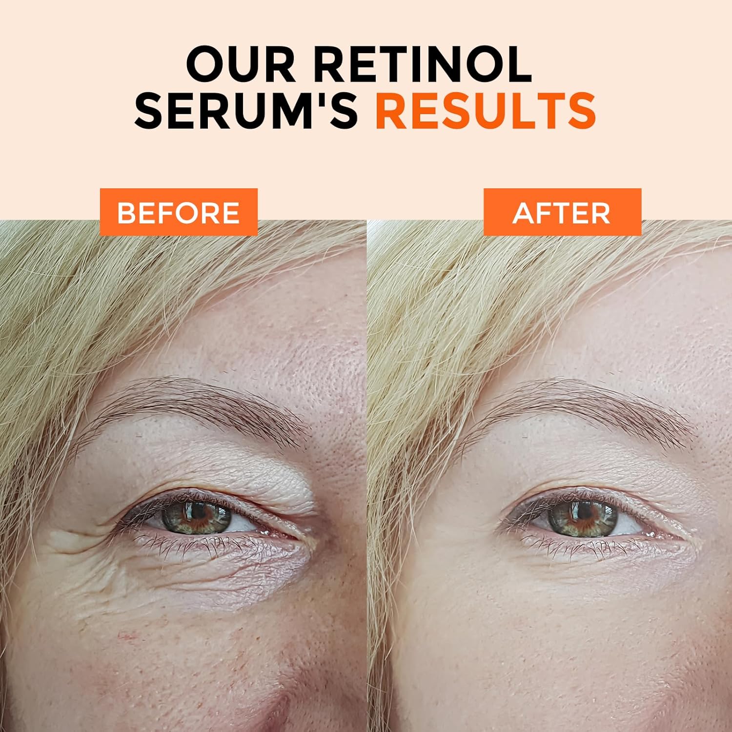 Retinol Serum for Face 2.5%, B5 Resurfacing Retinol Serum with Vitamin C, Vitamin E, Hyaluronic Acid, Niacinamide, Peptide for Anti-Aging, Wrinkle Smoothing, Dark Spot Corrector, Brighten Dullness - Image 5